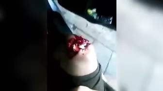 Tragic! Man Injured His Knee In Accident