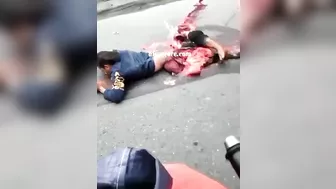 An Accident Left Two People Dead And A Body Torn In Half
