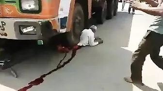When A Person Survives Under The Wheels Of A Truck