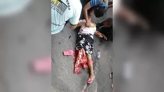Woman Falls And Breaks Her Leg