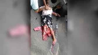 Woman Falls And Breaks Her Leg