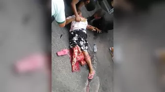 Woman Falls And Breaks Her Leg