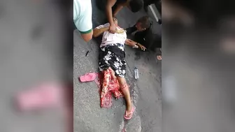 Woman Falls And Breaks Her Leg
