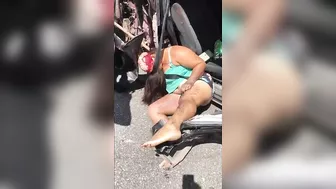 Woman Suffered Scalp Scalp In Accident