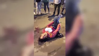 Two Motorcycles Collided, Woman's Legs Were Severely Shattered