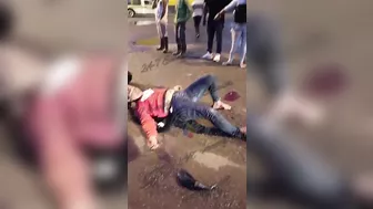 Two Motorcycles Collided, Woman's Legs Were Severely Shattered