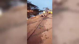 Two Motorcycles Collided, Woman's Legs Were Severely Shattered