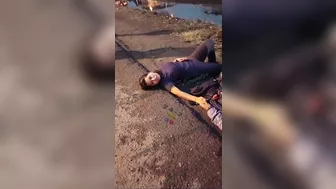 Two Motorcycles Collided, Woman's Legs Were Severely Shattered