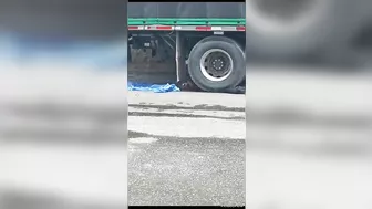 A Woman's Skull Was Crushed In A Horrific Motorcycle Accident.