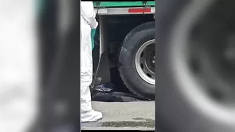 A Woman's Skull Was Crushed In A Horrific Motorcycle Accident.