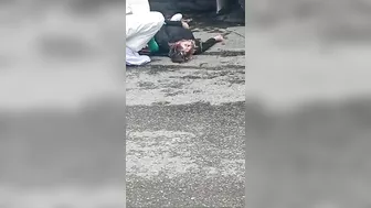 A Woman's Skull Was Crushed In A Horrific Motorcycle Accident.