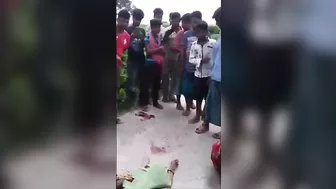 A Woman's Skull Burst Out Of Her Skin In An Accident In India