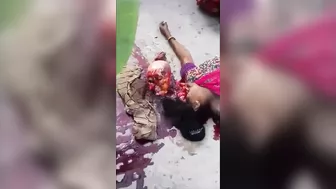 A Woman's Skull Burst Out Of Her Skin In An Accident In India