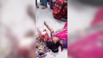 A Woman's Skull Burst Out Of Her Skin In An Accident In India