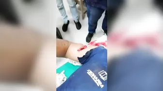 Work Accident Glass Cutting Aorta Version [Action & AF