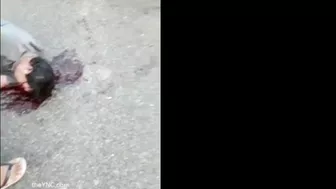 7 Accident
