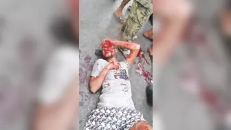 Two Young People Involved In Serious Traffic Accident