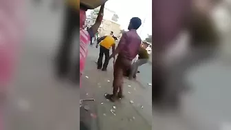 Accident - Internal Organs Coming Out Of The Stomach