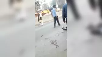 Accident - Internal Organs Coming Out Of The Stomach