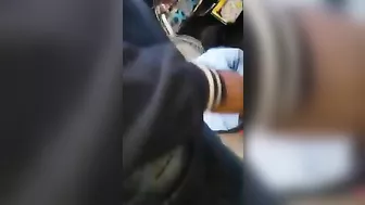 Accident - Internal Organs Coming Out Of The Stomach