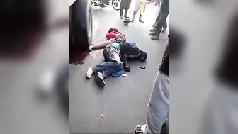 The Aftermath Of A Brutal Motorcycle Accident