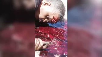 The Cyclist Was Still Breathing, With Blood And Brain Pouring Out Of His Skull