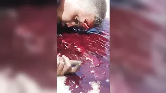 The Cyclist Was Still Breathing, With Blood And Brain Pouring Out Of His Skull