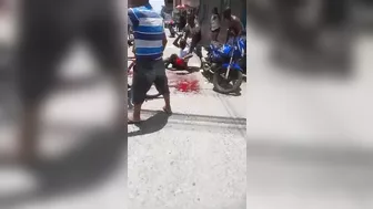 Biker's Leg Destroyed