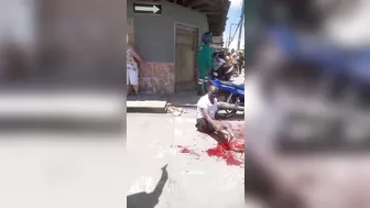 Biker's Leg Destroyed