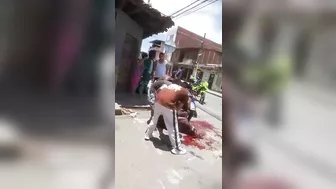 Biker's Leg Destroyed