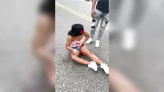 Chicken Shocked, Face Peeled