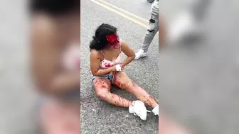 Chicken Shocked, Face Peeled