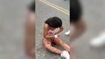 Chicken Shocked, Face Peeled