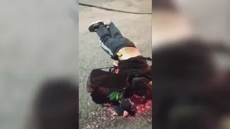 A Football Fan Was Hit On The Head