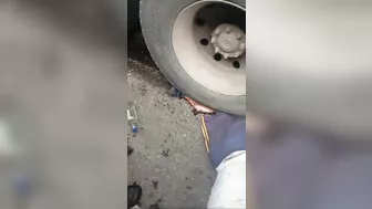 Football Fan's Legs And Dreams Destroyed By Truck