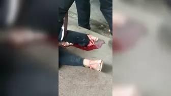 Her Foot Is Broken.