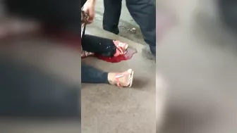 Her Foot Is Broken.