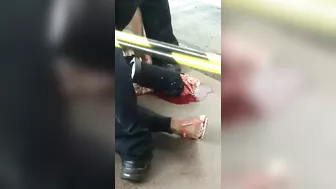 Her Foot Is Broken.