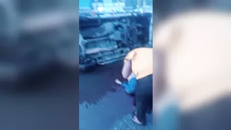 I Don't Think CPR Would Help Him