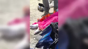 Motorcyclist Suffers Serious Leg Injuries After Crashing Under Truck
