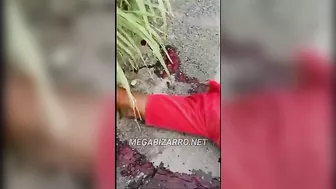 Man's Body Destroyed By Truck