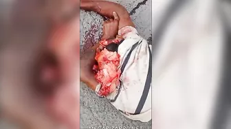 Man's Body Destroyed By Truck