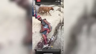 Shocked Man Tries To Sew Severed Leg Back Together