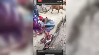 Shocked Man Tries To Sew Severed Leg Back Together