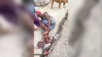 Man Tries To Sew Severed Leg Back Together