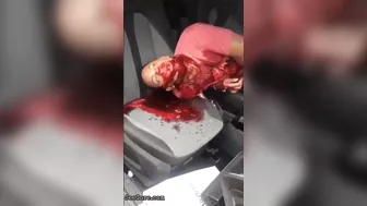 Man Seriously Injured In Accident