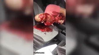 Man Seriously Injured In Accident
