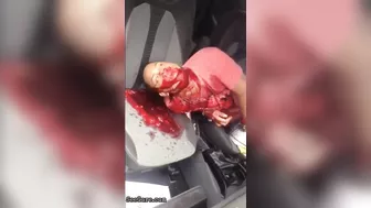 Man Seriously Injured In Accident