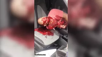 Man Seriously Injured In Accident