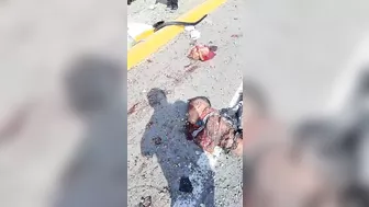 At Least 13 Injured In Bus Accident In La Libertad, Peru